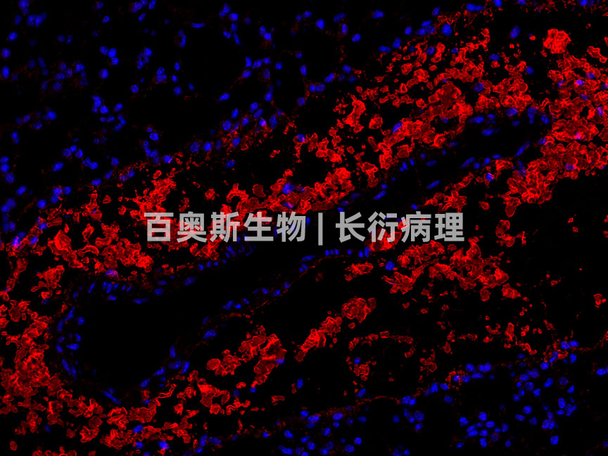 collagen-I(red)---小鼠-肺-300倍---86底板.jpg