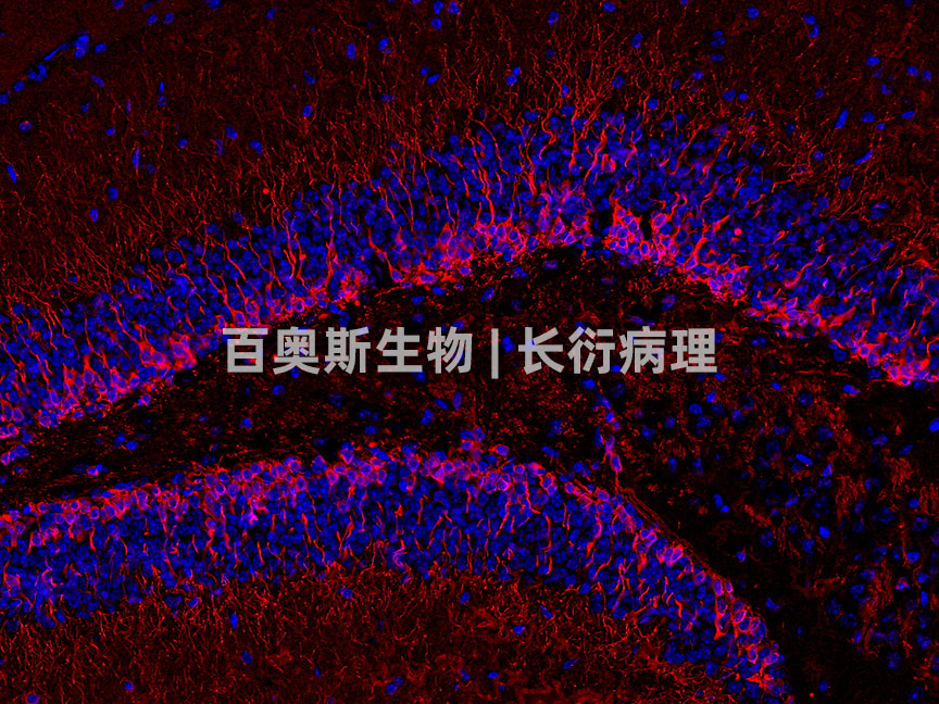 Doublecortin(red)---小鼠-脑---86底板.jpg