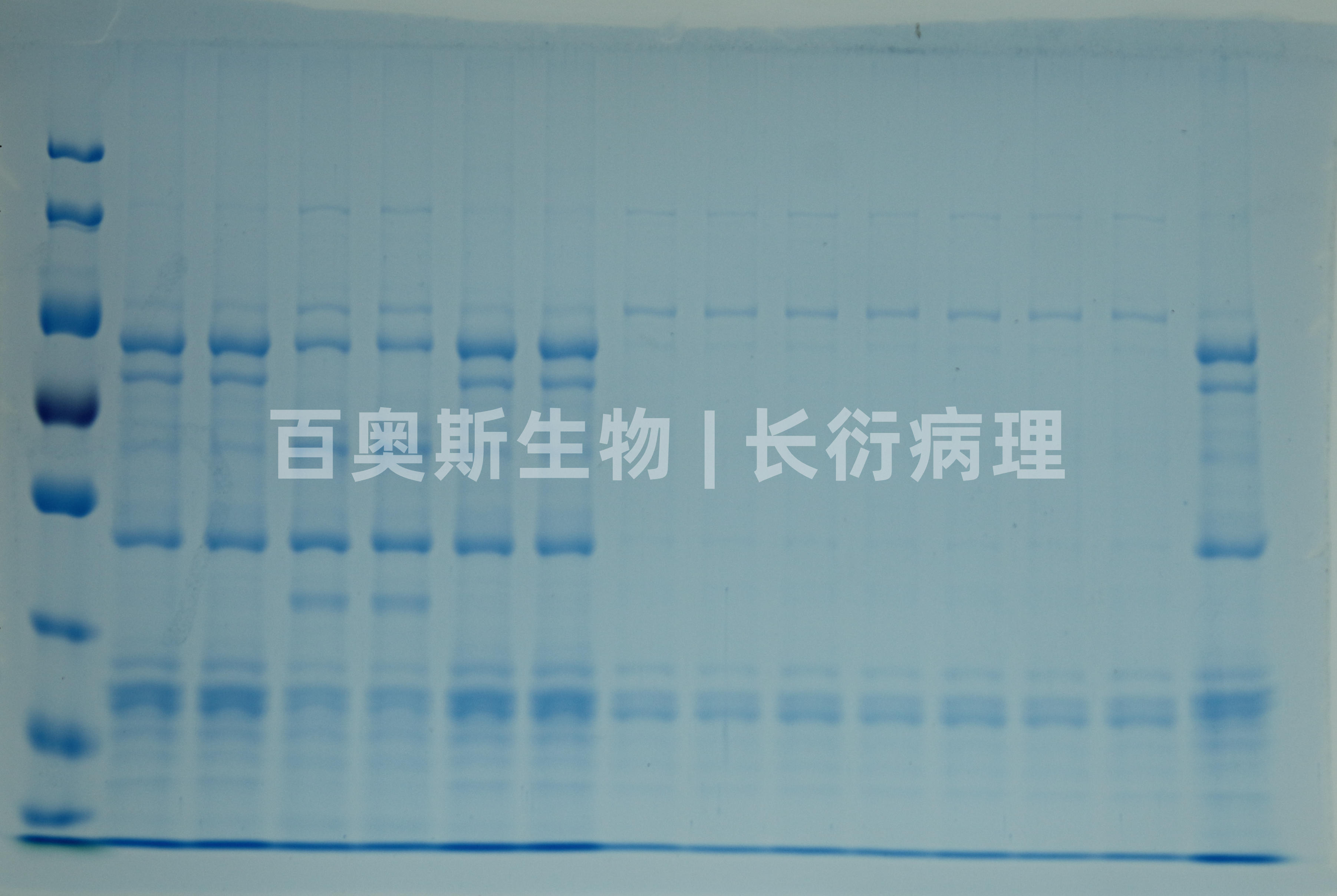 蛋白电泳染色图.jpg