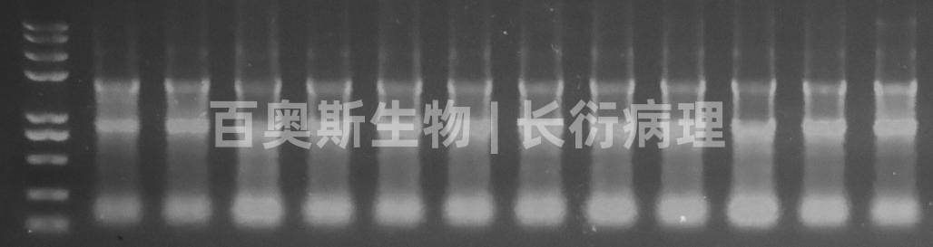 Trizol法RNA提取电泳图-1.jpg