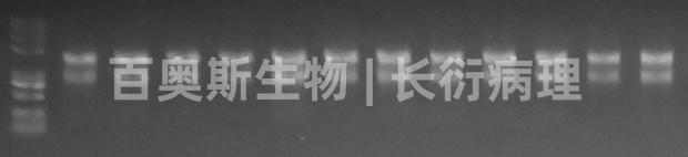 试剂盒RNA提取电泳图-1.jpg