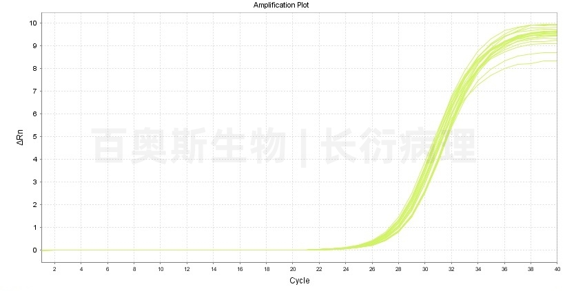 lncRNA qPCR扩增曲线-1.jpg