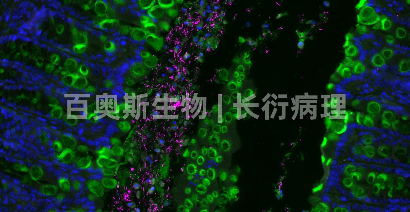 小鼠 结肠 Eub338 Cy5+MUC2 Green_副本.jpg