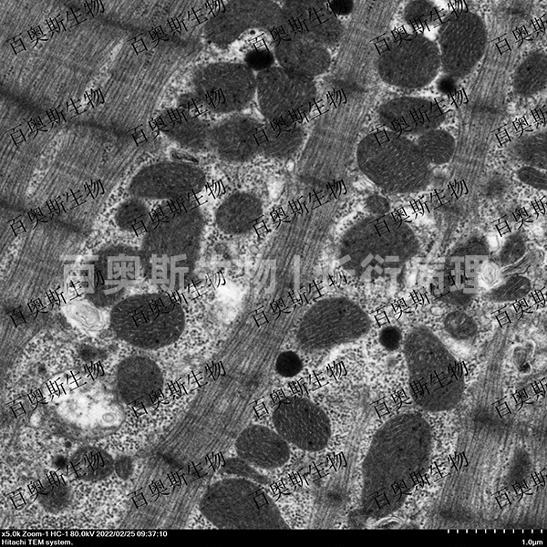 透射电镜 心肌细胞肌节+线粒体-2.jpg