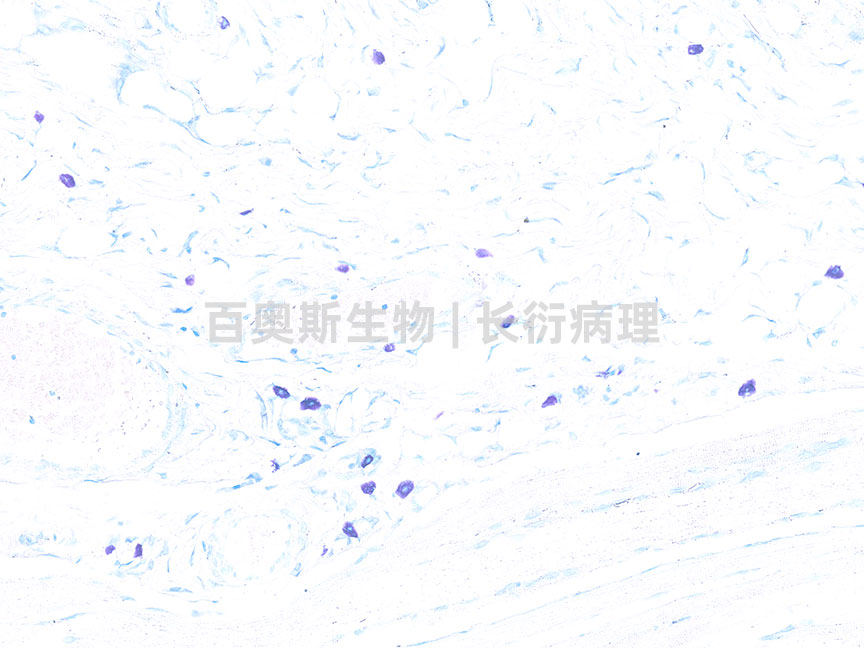 甲苯胺蓝---小鼠-肥大细胞---86底板.jpg