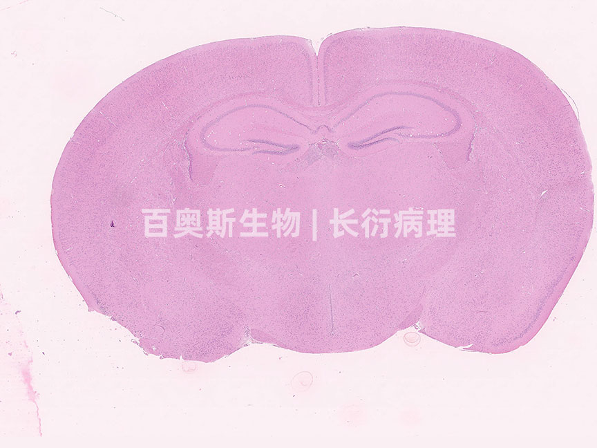 HE---脑横切---86底板.jpg