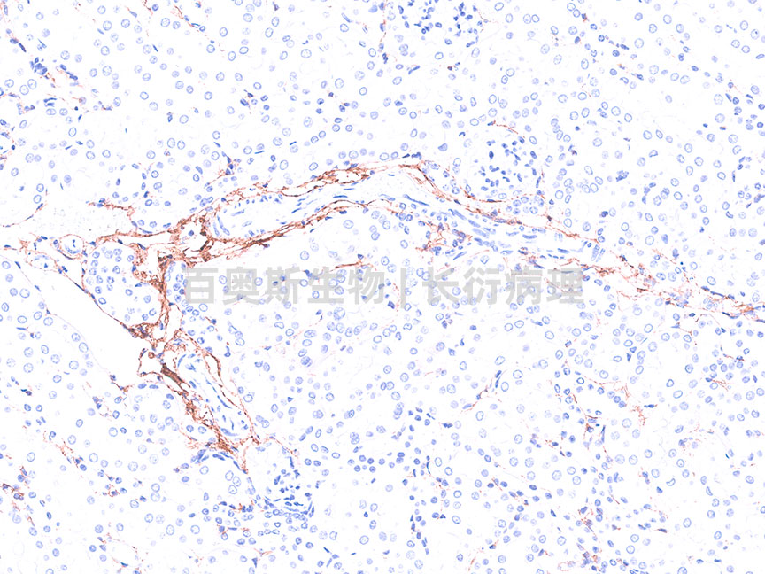 collagenⅢ---小鼠-肾-200倍---86底板.jpg