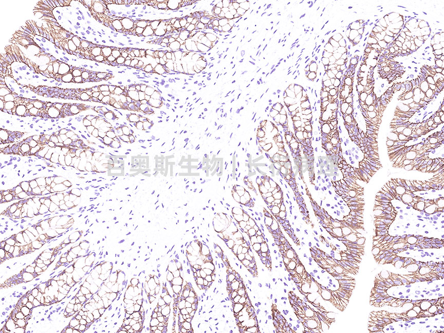 E-Cadherin---大鼠-结肠2---86底板.jpg
