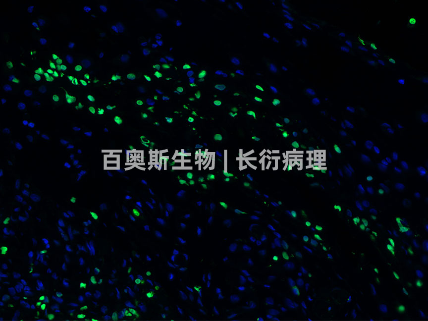 Tunel(green)---小鼠-肿瘤-300倍---86底板.jpg