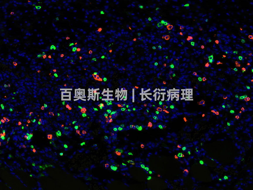 CD4(green)+CD8(orange)---小鼠-肿瘤-200倍---86底板.jpg