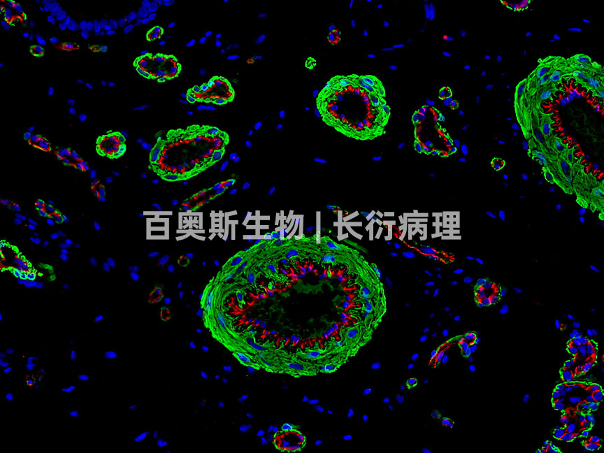 α-SMA(green)+CD31(red)---小鼠-肿瘤-200倍---86底板.jpg