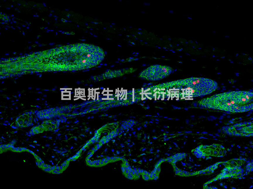 β-Catenin(green)+ki67(red)---小鼠-皮肤-200倍---86底板.jpg