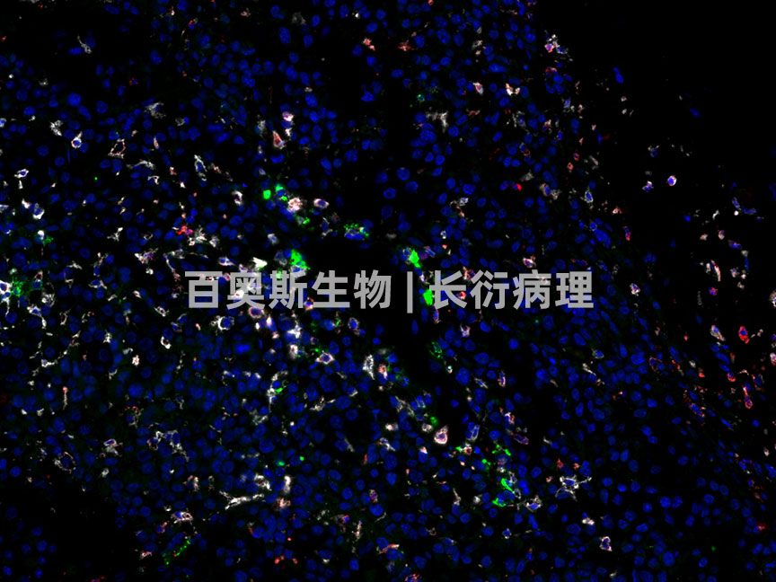 86-M-肿瘤-PD-L1-FITC+CD206-CY3+F480-CY5-1.jpg